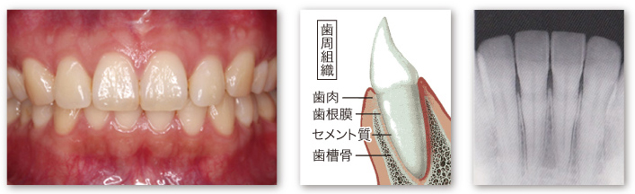 健康な状態