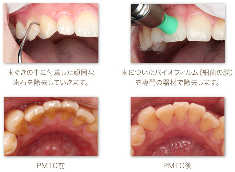 専門的なプロフェッショナルケア